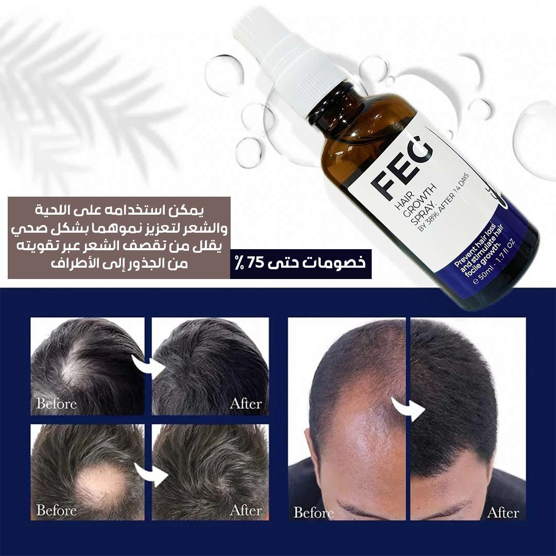 FEG Hair Growth Spray - Image 3