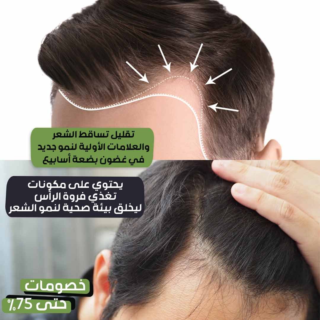 Volumizing Spray - Image 4