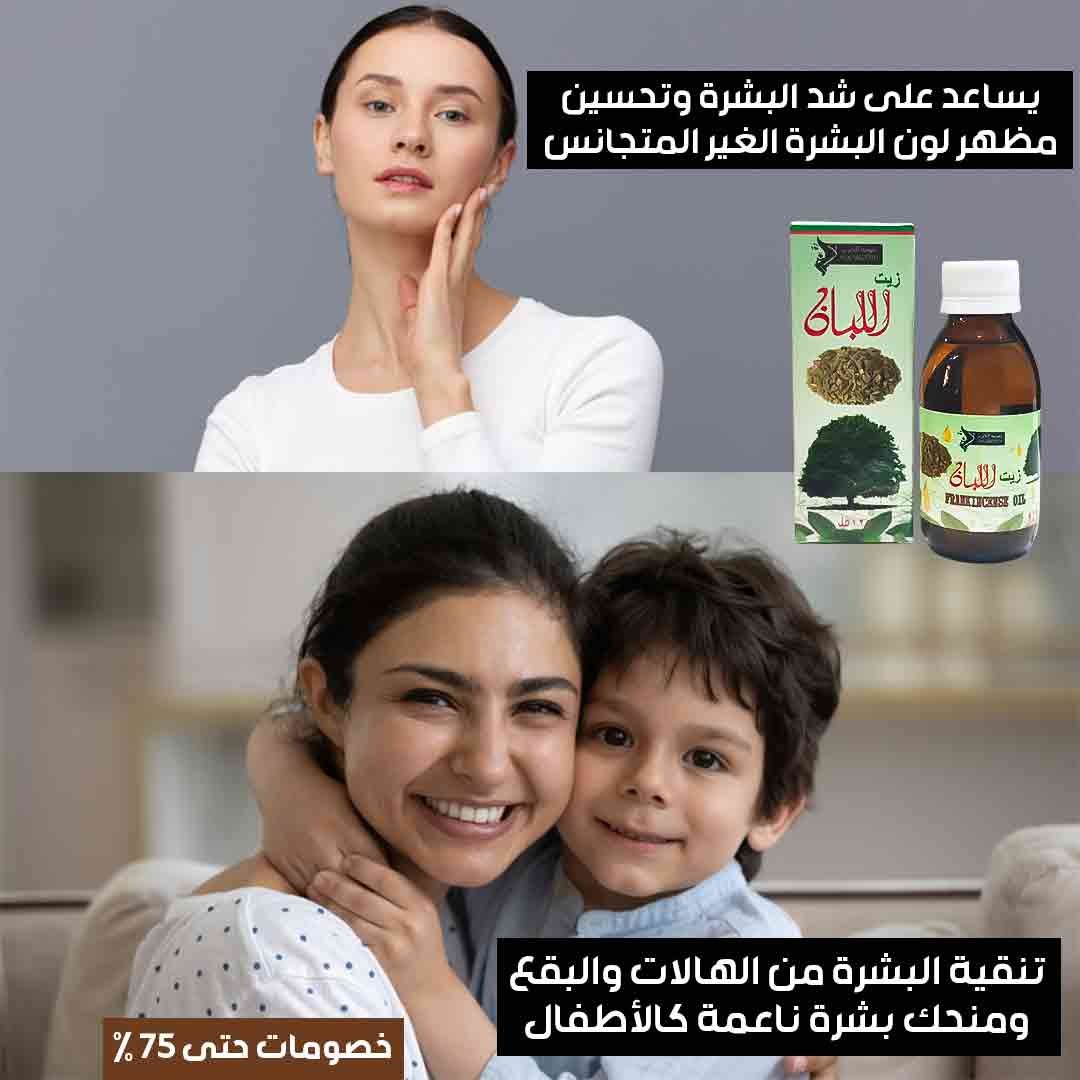 Frankincense oil for hair and skin - Image 3