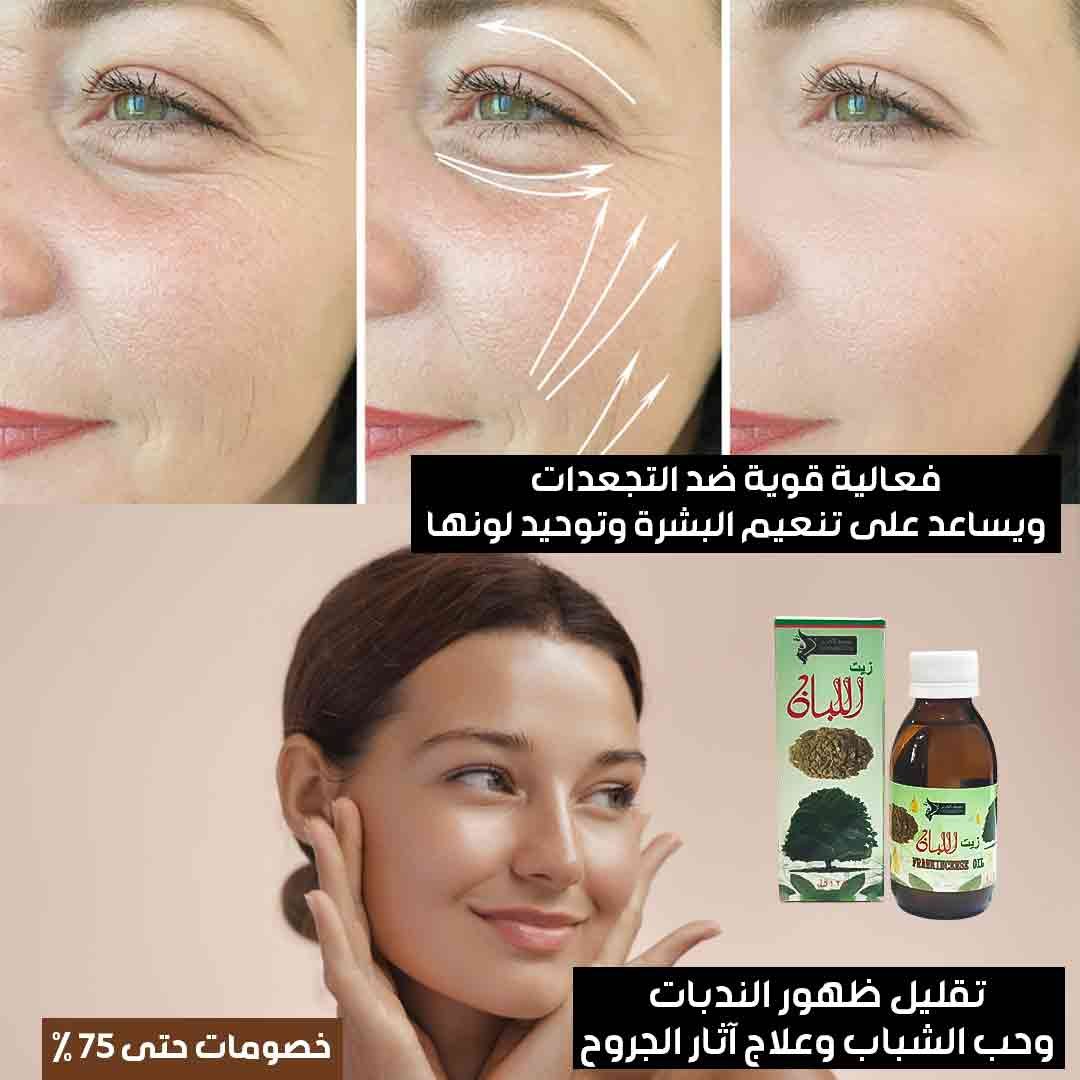 Frankincense oil for hair and skin - Image 4