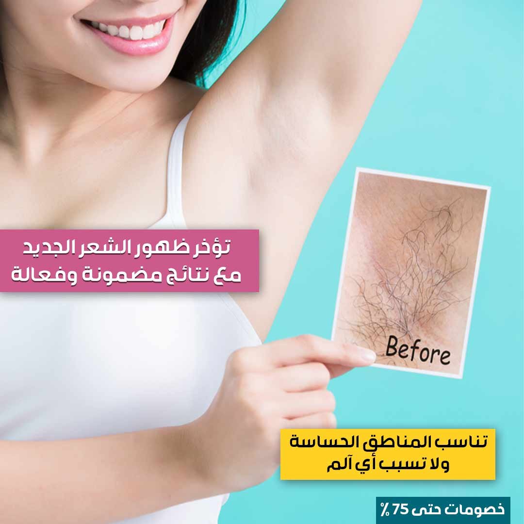 ماكينة إزالة الشعر 4 في 1 - الصورة 4