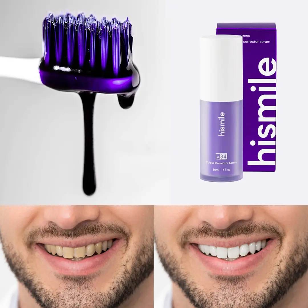 جل تبييض الأسنان - الصورة 8